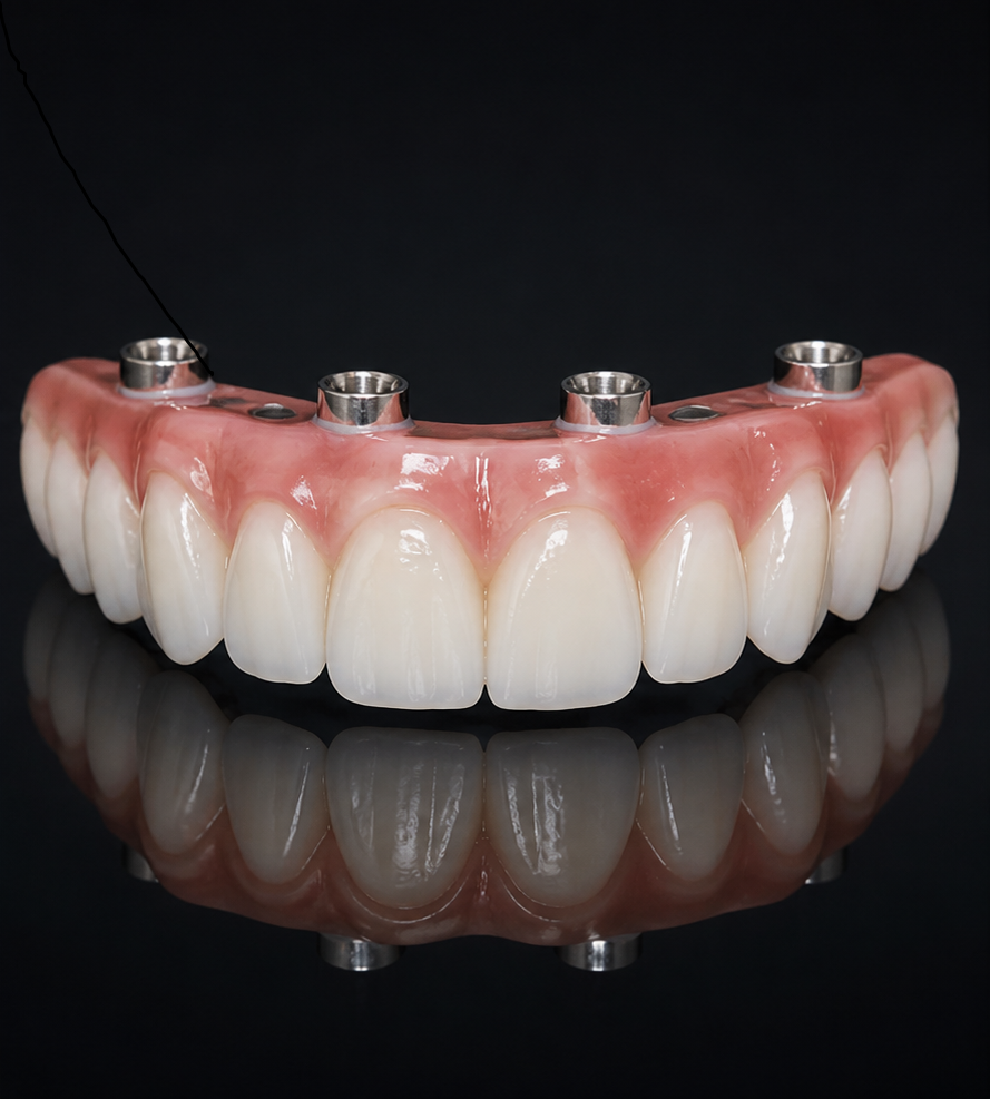 Full-arch implant denture for All-on-4-style treatment